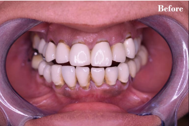 Before — comprehensive dental care at Cura Smiles